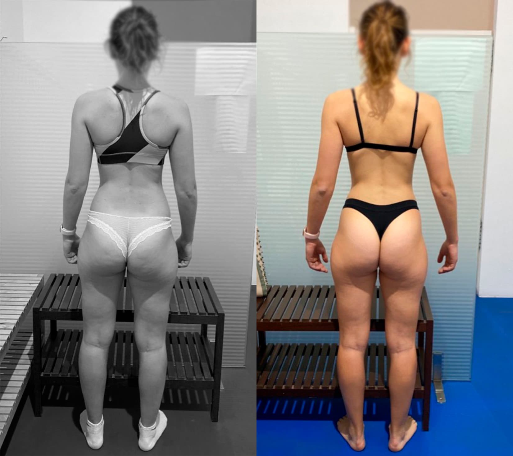Virginia Bebassa — Vista posterior